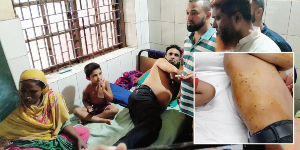 গুলি-দগদগে ঘা নিয়ে কাতরাচ্ছেন সোবহান