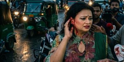 নায়িকার কান ছিঁড়ে নিল ছিনতাইকারী!
