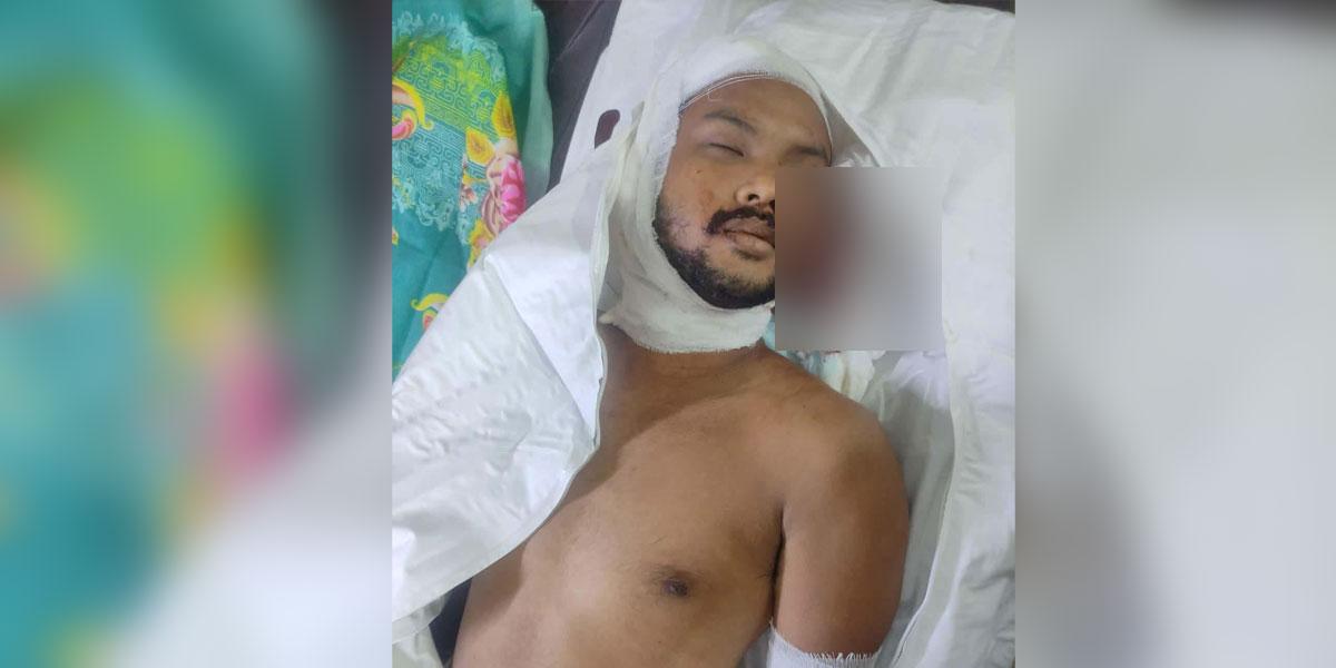 বন্দরের বহির্নোঙরে বিদেশি নাবিকদের সংঘর্ষে নিহত ১