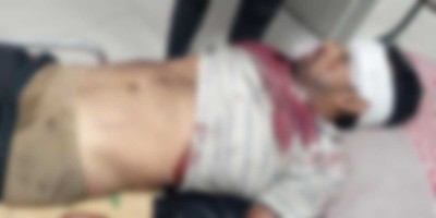 জিপিএইচ ইস্পাত কারখানায় লোহার আঘাতে শ্রমিক নিহত