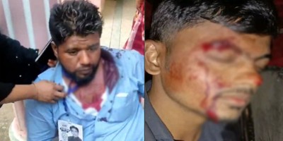 চট্টগ্রামে নির্বাচনপরবর্তী সহিংসতায় আহত ৭