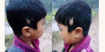 শিক্ষার্থীর চুল উপড়ে দেওয়ার অভিযোগ শিক্ষকের বিরুদ্ধে