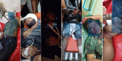 লক্ষ্মীপুরে ছাত্রলীগের চার নেতাকর্মী গুলিবিদ্ধসহ আহত ৬
