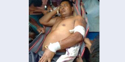 বিলাইছড়িতে ইউপি চেয়ারম্যান গুলিবিদ্ধ