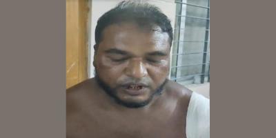 নারীকে উত্ত্যক্তের প্রতিবাদ করায় বখাটের ছুরিকাঘাতে যুবক আহত