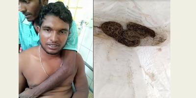 বস্তায় ভরে সাপ নিয়ে রামেক হাসপাতালে আহত যুবক