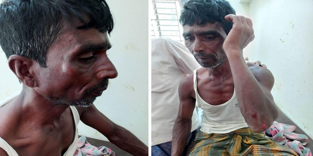 জমি দখল নিতে না পেরে সাঁওতাল শ্রমিককে মারধর