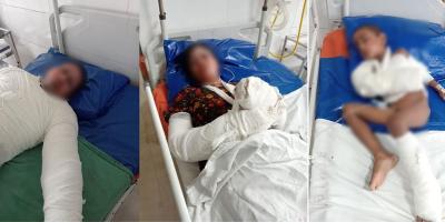 বাইরে থেকে ঘরের দরজা আটকে আগুন, শিশুসহ দগ্ধ ৪