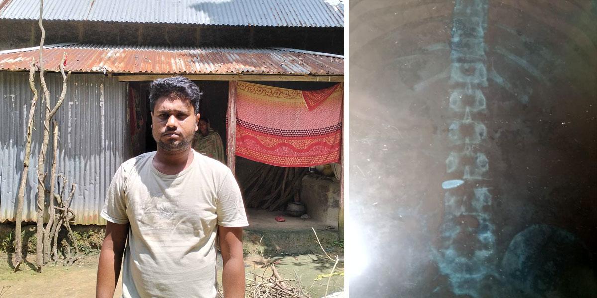 ‘গুলিটা বের করে দেন, যেন কাজ করে খেতে পারি’