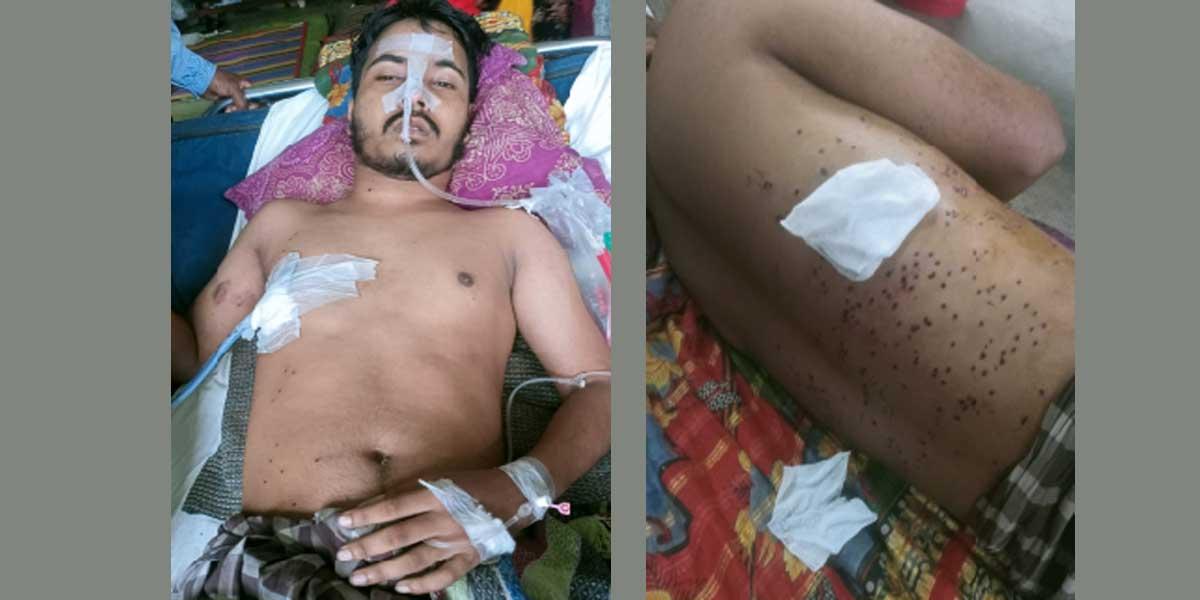 কবে সুস্থ হয়ে বাড়ি ফিরবেন নবী