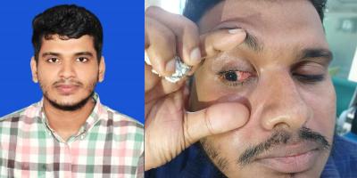 রায়হানের দৃষ্টিশক্তি ফেরাতে নিতে হবে বিদেশে