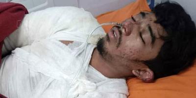 আমতলীতে ৫ আগস্ট দগ্ধ স্কুলছাত্র তেশাম মারা গেছে