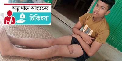 সুস্থ হয়নি ঊরুতে গুলিবিদ্ধ তোফাজ্জল