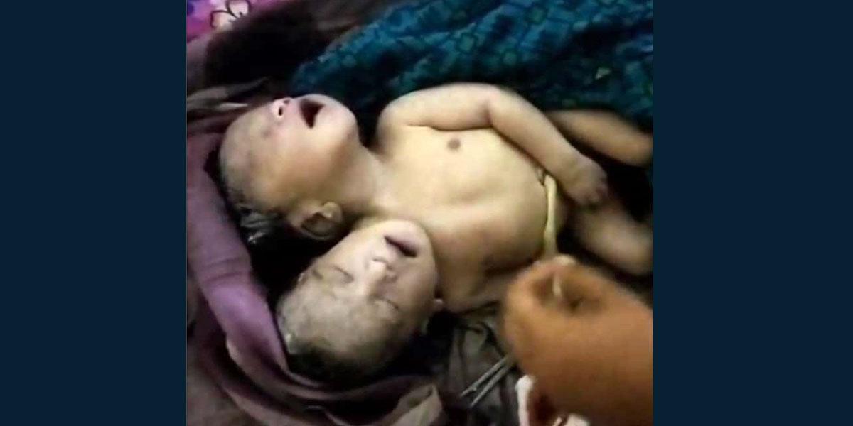 শার্শায় ২ মাথা নিয়ে জন্ম নেওয়া শিশুর মৃত্যু