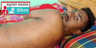 ‘ব্যথায় ঘুমাতে পারি না’