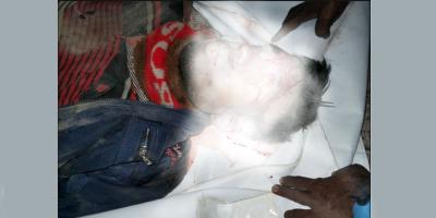 মোংলায় সড়ক দুর্ঘটনায় নিহত ২, আহত ৩