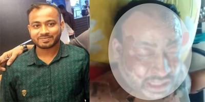 পরকীয়ার জেরে যুবকের গায়ে আগুন, ৫ দিন পর মৃত্যু
