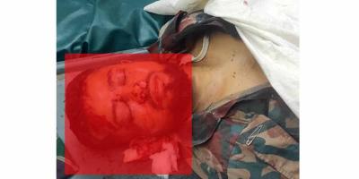 চোরাকারবারিদের ধাওয়া করতে গিয়ে গাছের সঙ্গে মোটরসাইকেলের ধাক্কা, বিজিবি সদস্য নিহত