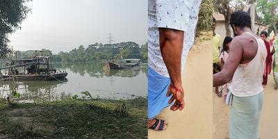 মিরসরাইয়ে বালু উত্তোলনে বাধা, ৩ জনকে কুপিয়ে জখম