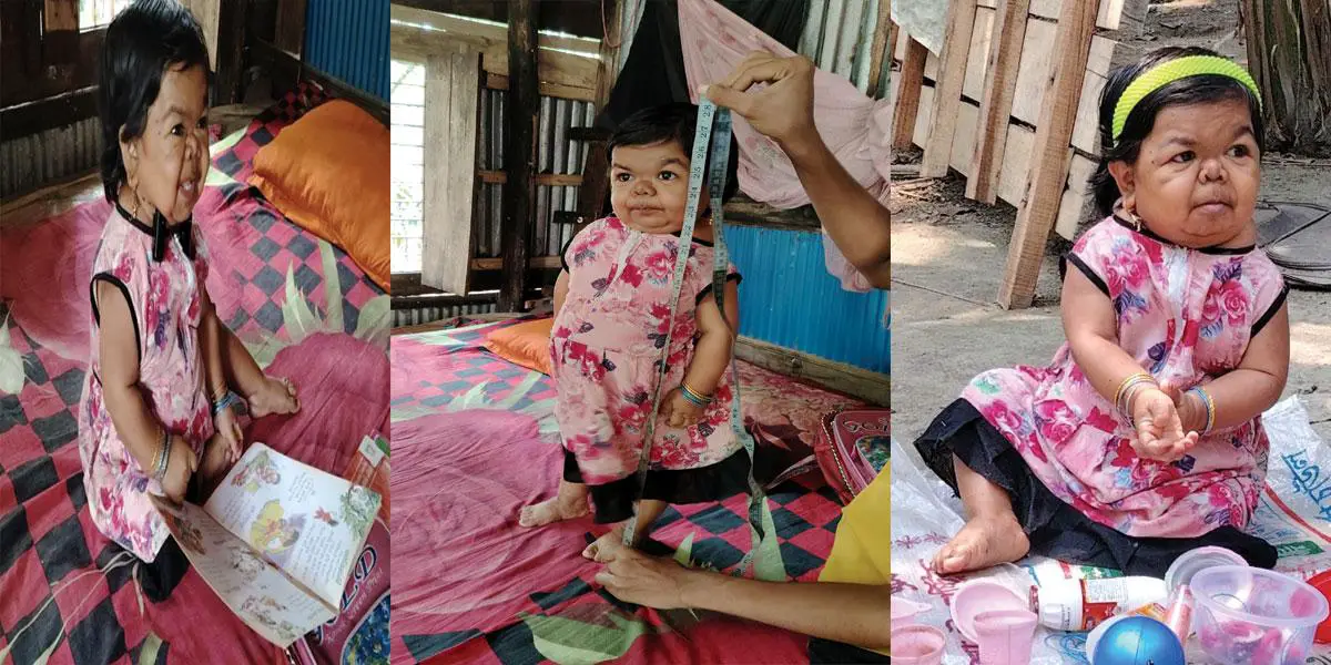 ৩৪ বছরের মিলির উচ্চতা ২৮ ইঞ্চি!