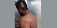 মুন্সীগঞ্জে মাদক ব্যবসায়ীদের হামলায় ডিবির ৩ পুলিশ সদস্য আহত