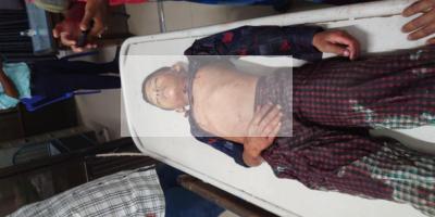 পটুয়াখালী‌তে আতশবা‌জিতে প্রাণ গেল শিশুর