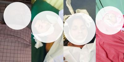উখিয়ায় সংঘর্ষ: আরও এক নারীর মৃত্যু