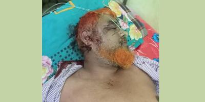 ঘোড়াশালে দুর্বৃত্তের গুলিতে কাভার্ডভ্যান চালক নিহত