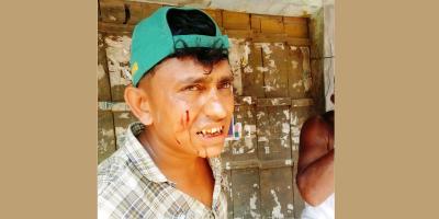 বাঁশখালীর লবণের মাঠ সংঘর্ষে আহত ৩০