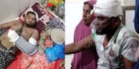 ফরিদপুরে ছিনতাইকারীদের চিনে ফেলায় কুপিয়ে জখম, গ্রেপ্তার ২