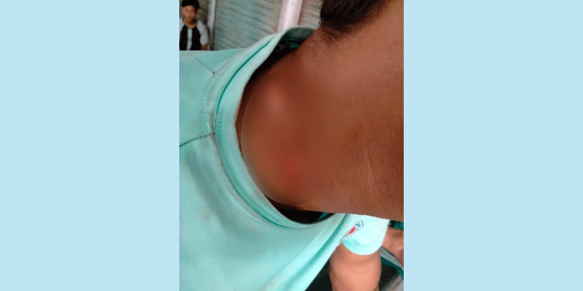 ঝিনাইদহে শ্মশান কমিটির সভাপতিকে কুপিয়ে আহত