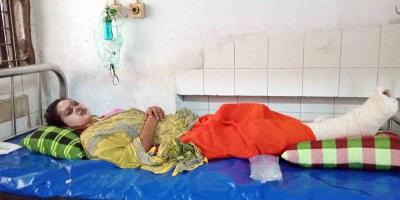 চাচা শ্বশুরের ছোড়া গরম পানিতে ঝলসে গেল গৃহবধূর শরীর
