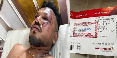 ভারতে বিমান দুর্ঘটনায় অলৌকিকভাবে বাঁচলেন এক যাত্রী