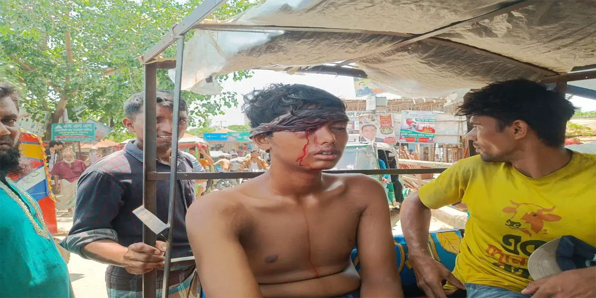 সরাইলে জমি নিয়ে দুই পক্ষের সংঘর্ষে আহত ৩০