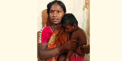 শিশু গোপালের পাশে দাঁড়াল প্রশাসন