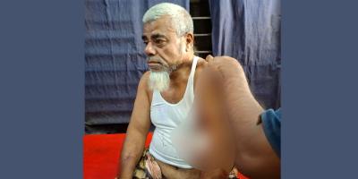 ঠাকুরগাঁওয়ে ব্যবসায়ীকে কুপিয়ে ৮ লাখ টাকা ছিনতাই