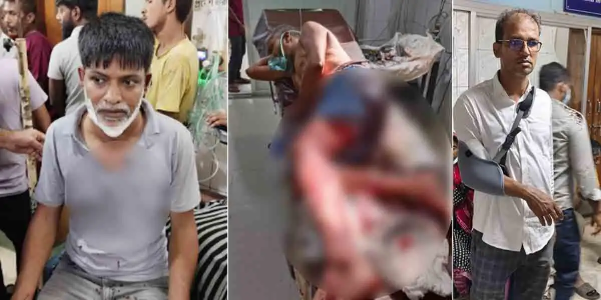 নগর ভবনে ঢাকাবাসীর আন্দোলনে হামলা, আহত বেশ কয়েকজন