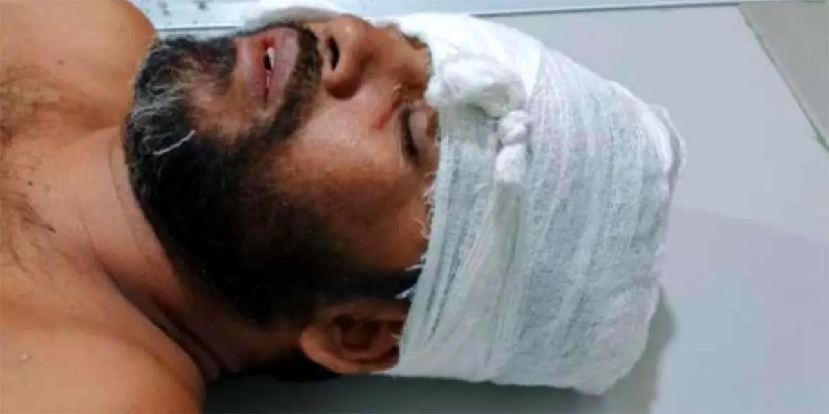 নলছিটিতে সাংবাদিককে কুপিয়ে জখম