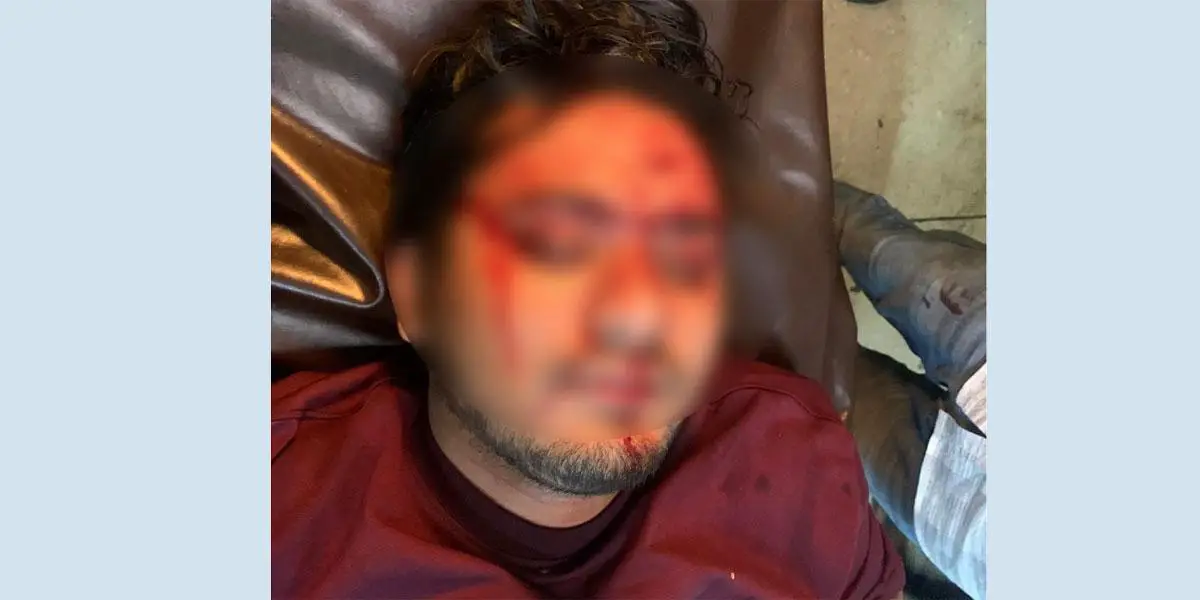 শেকৃবি শিক্ষার্থীদের ওপর ব্যবসায়ীদের হামলা, আহত ২