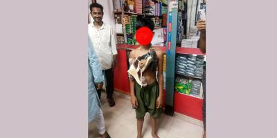 রাজবাড়ীতে চুরির অভিযোগে শিশুর গলায় জুতার মালা
