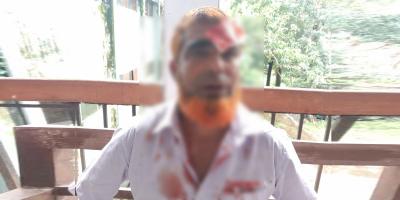 হত্যা মামলার সাক্ষীকে আদালতপাড়ায় হাতুড়িপেটার অভিযোগ