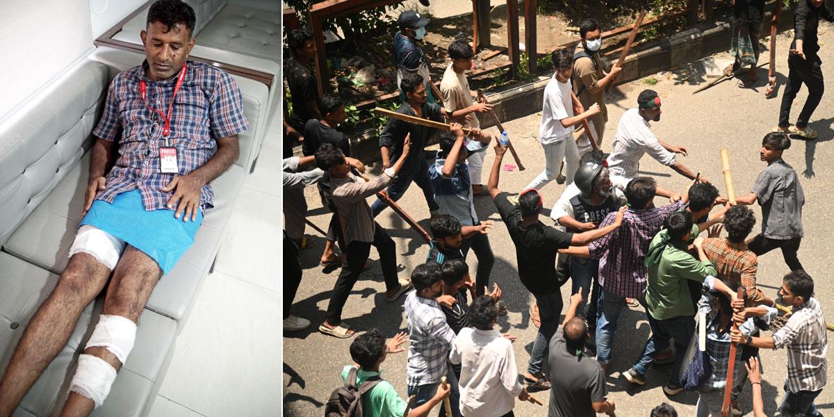 জ্ঞান ফিরতেই দেখি দুই পা রক্তাক্ত
