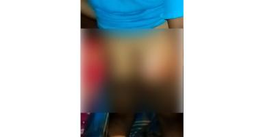খাবার আনতে দেরি, শিক্ষার্থীকে গরম খুন্তির ছ্যাঁকা