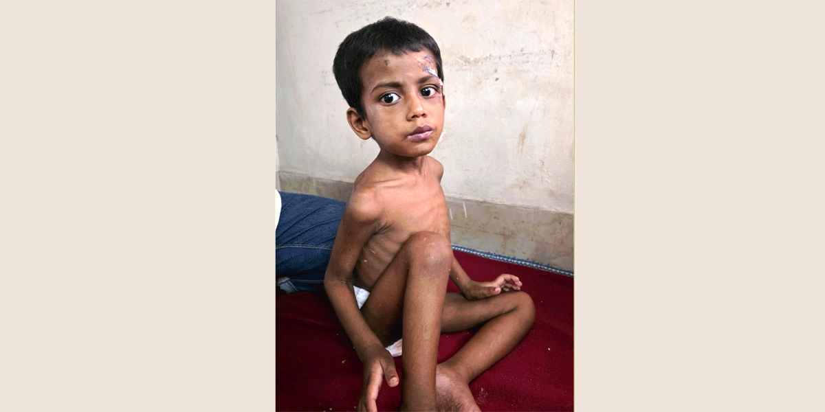 মাদকাসক্ত বাবার নির্যাতনের শিকার ৪ বছরের শিশু
