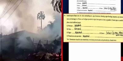 খাগড়াছড়ির ঘটনায় ধর্ষণের আলামত মেলেনি মেডিকেল পরীক্ষায়