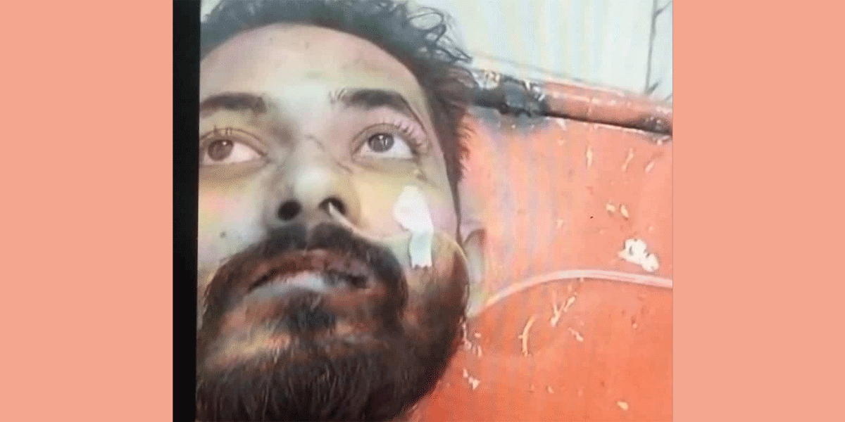 জঙ্গলসলিমপুরের সংঘর্ষের ঘটনায় গুলিবিদ্ধ আরেক যুবকের মৃত্যু