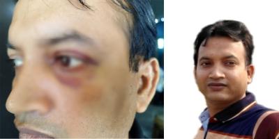 বরগুনায় স্কুলশিক্ষককে অপহরণ করে নির্যাতন ও সর্বস্ব লুট