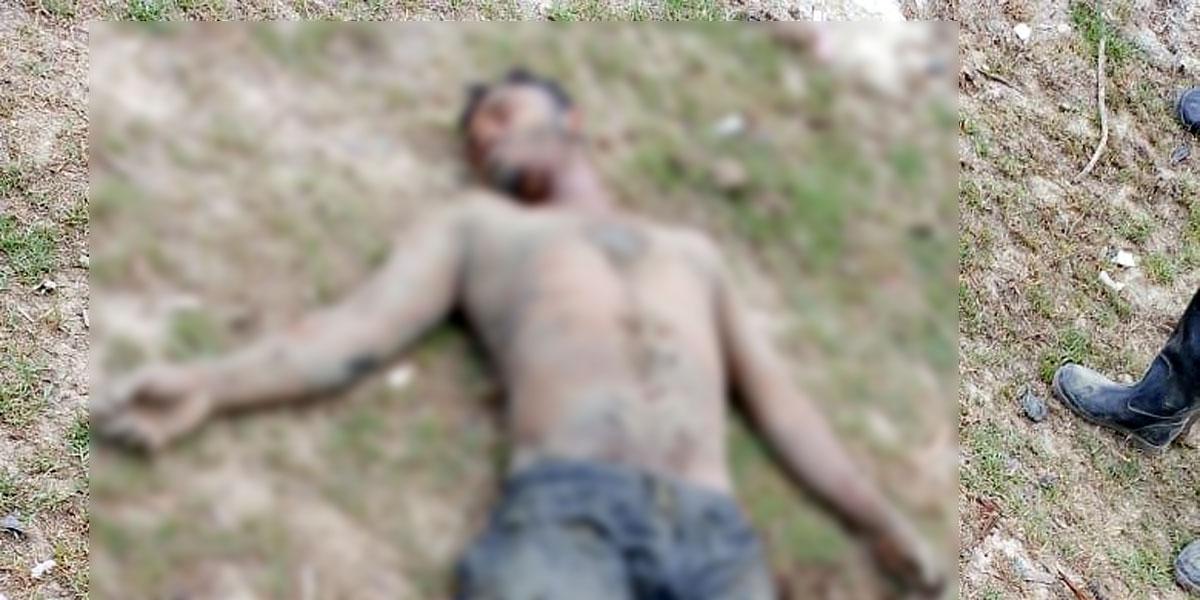 উখিয়া সীমান্তে মাইন বিস্ফোরণে রোহিঙ্গা যুবকের পা ক্ষতবিক্ষত