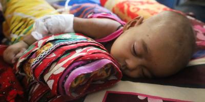 হাম-উপসর্গে আরও ১২ শিশুর মৃত্যু, হাসপাতালে ১৩০৩