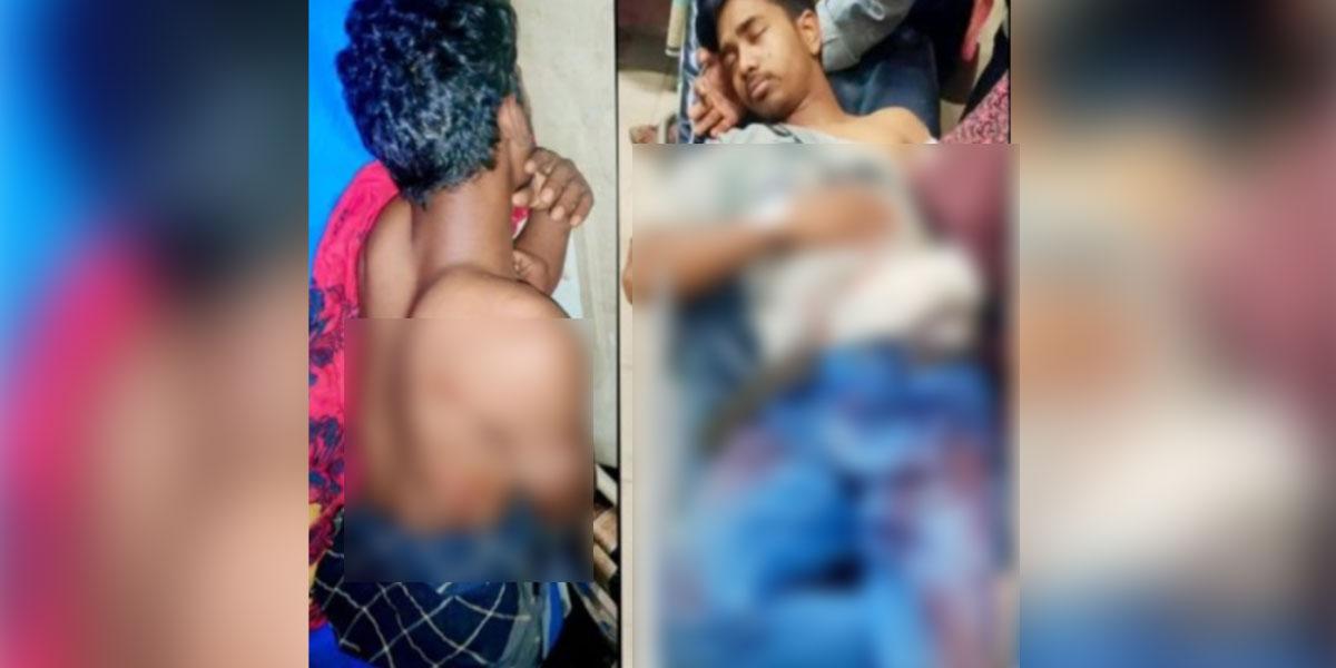 লোহাগাড়ায় সন্ত্রাসীদের গুলিতে দুই অটোরিকশাচালক গুলিবিদ্ধ
